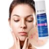 Picture of REVUELE NO PROBLEM PORE - LOTIUNE DE CURATARE ANTI-ACNEE SI IMPOTRIVA PUNCTELOR NEGRE, 200 ml