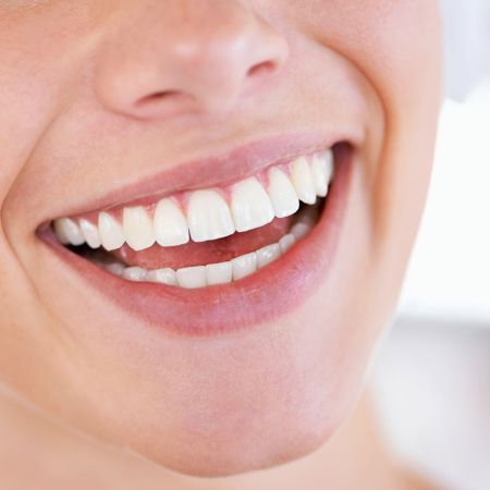 Picture for category Teeth Whitening