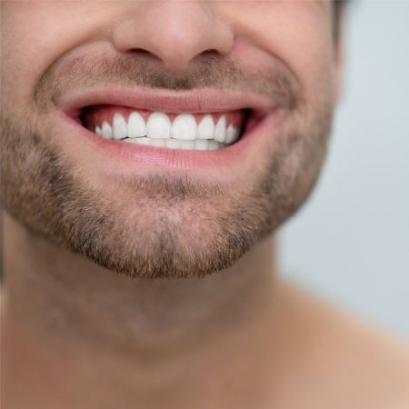 Picture for category Teeth Whitening